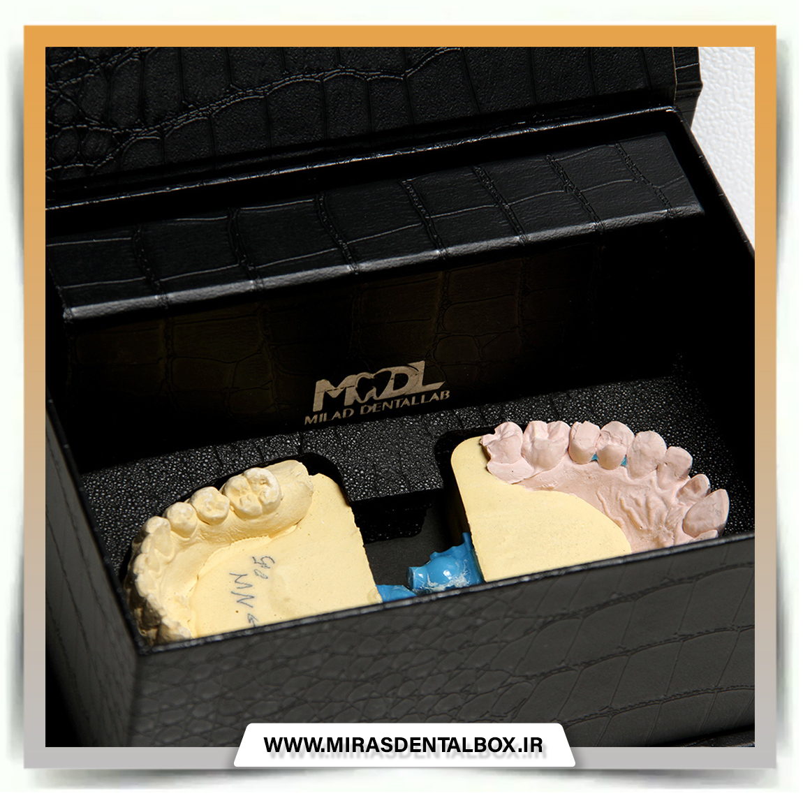 فول باکس میکرو لاکچری